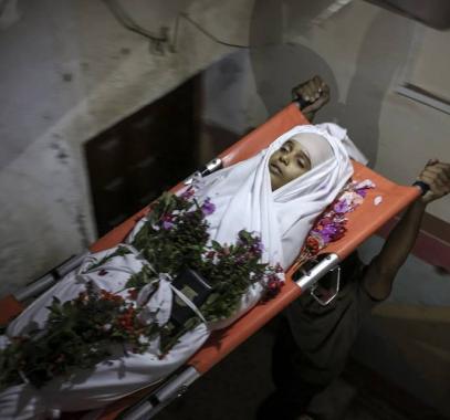 بالصور: خبِّئوا أرنب التشريح... فناصر أصبح اليوم 