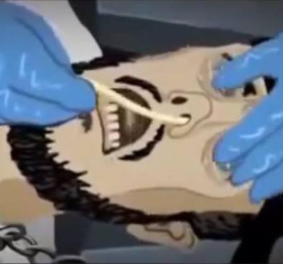 التغذية القسرية.jpg