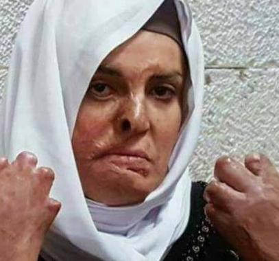 نقل الأسيرة جعابيص لمشفى 