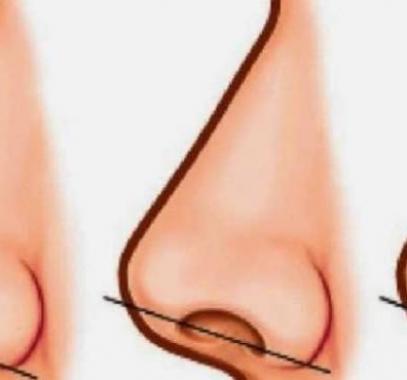 مذهل وغريب جدا : لن تصدقوا على ماذا يدل حجم فتحة الأنف!