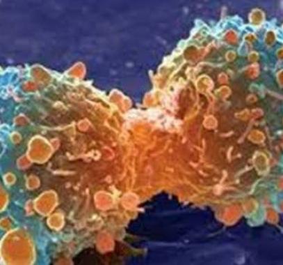 إحذروا تناول هذه الأطعمة... قد تسبب لكم السرطان!