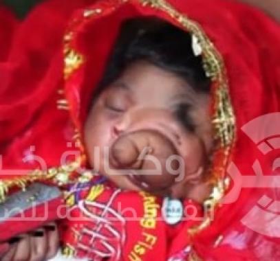 طفلة بخرطوم فيل