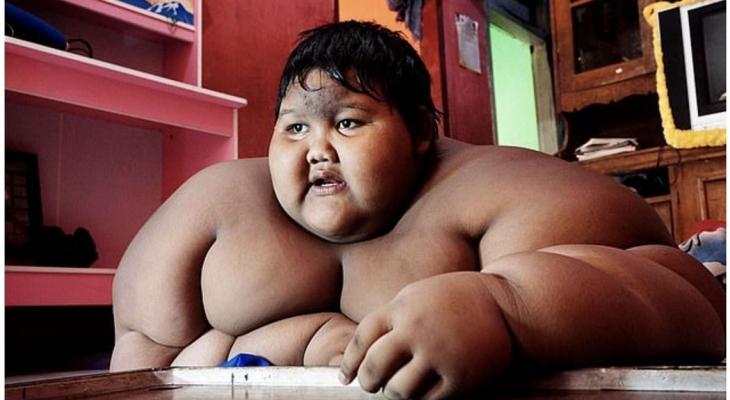 بالصور: أسمن طفل في العالم يفقد 106 كيلو من وزنه في شهر!