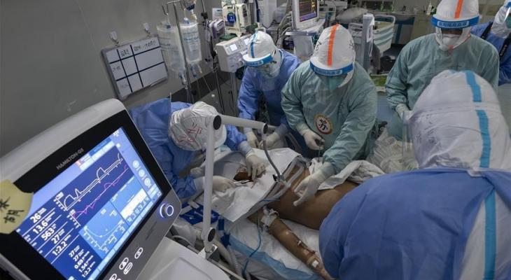 بالصور: نزع جهاز التنفسي عن مريض بكورونا في الصين واستعادة الرئتين وظائفهما