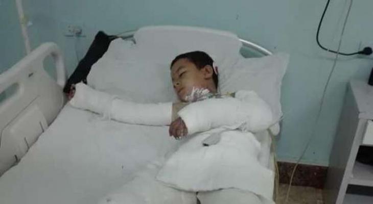 مصر:وفاة طفل بعد شهر من تعرضه "للتنمر" بطريقة بشعة