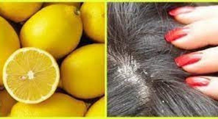 الليمون يحافظ على صحة الشعر والتخلص من قشرة الرأس