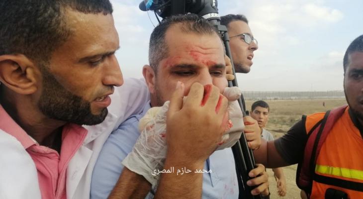 إصابة المصور عاصم شحادة شرق غزة