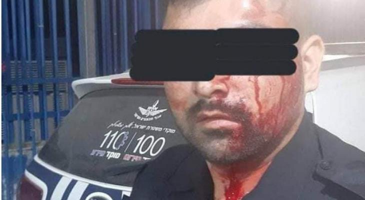 الاحتلال ينظر اليوم بتمديد اعتقال شابيْن تصديا للشرطة الإسرائيلية في كفر قاسم