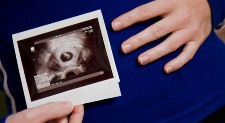 أسباب عدم ظهور كيس الحمل في الرحم