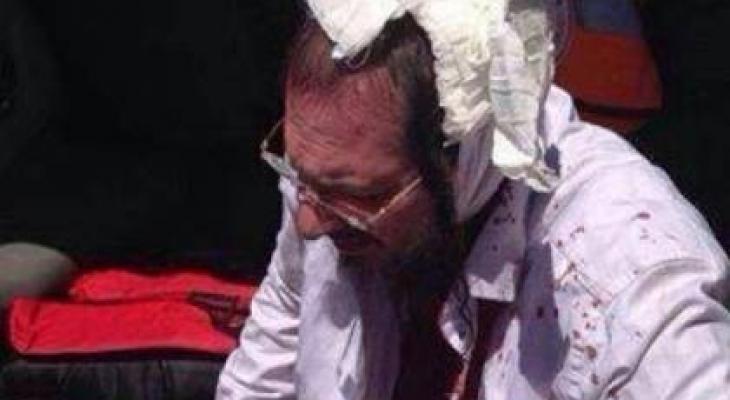 العبري يزعم إصابة 10 مستوطنين جراء رشقهم بالحجارة في نابلس