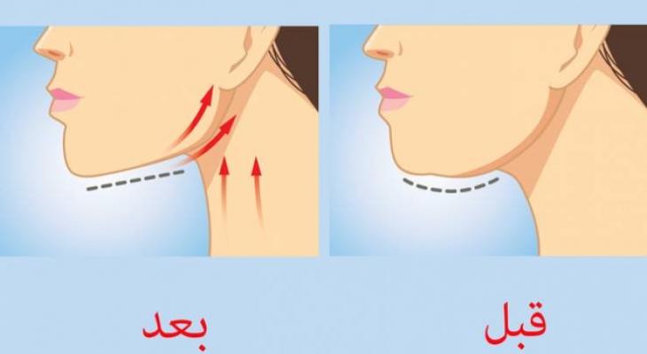 تخلص من الذقن المزدوج بهذه المادة السحرية الفعالة!