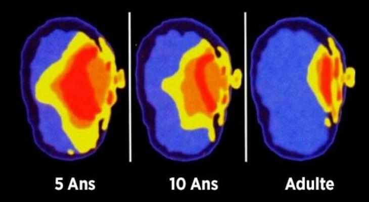 voici-ce-que-font-les-smartphones-sur-le-cerveau-des-enfants-jpg-64406164366508817