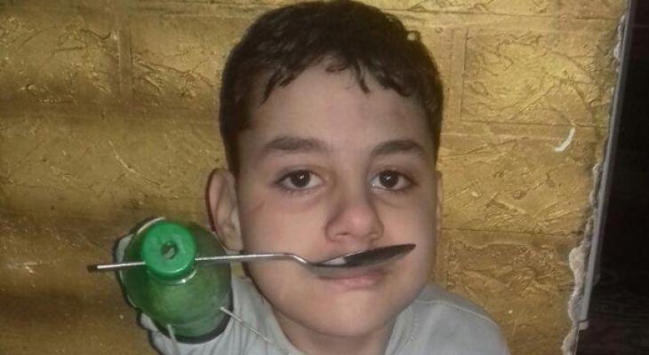 طفل مصري ولد بدون أطراف.. فاستعان بقارورات بلاستيكية