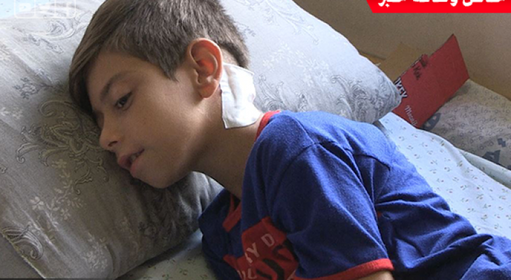 بالفيديو: عملية جراحية نوعية بغزّة أنقذت حياة طفل وأعادت الابتسامة لعائلته 