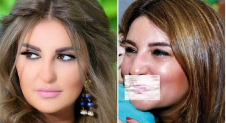 التقاط