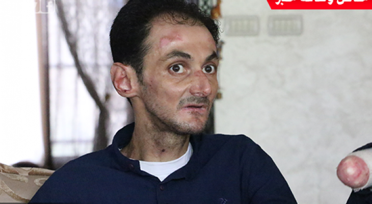 مصاب بمرض نادر يروي فصول معاناته عقب قرار وقف توريد الأدوية لقطاع غزة