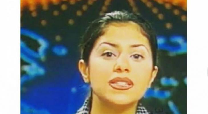 بالصور : لن تصدقوا من هذه النجمة العربية قبل عمليات التجميل!