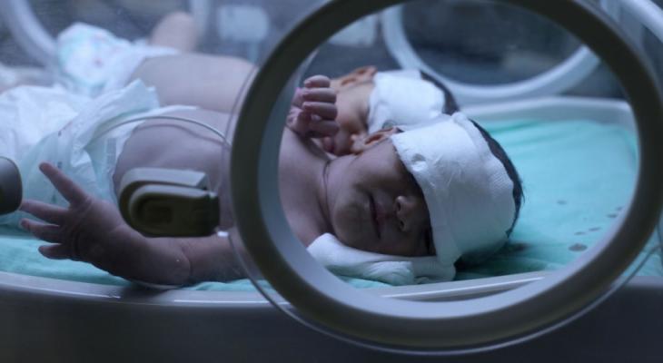 صحة غزة: انخفاض نسبة وفيات الأمومة خلال 2017