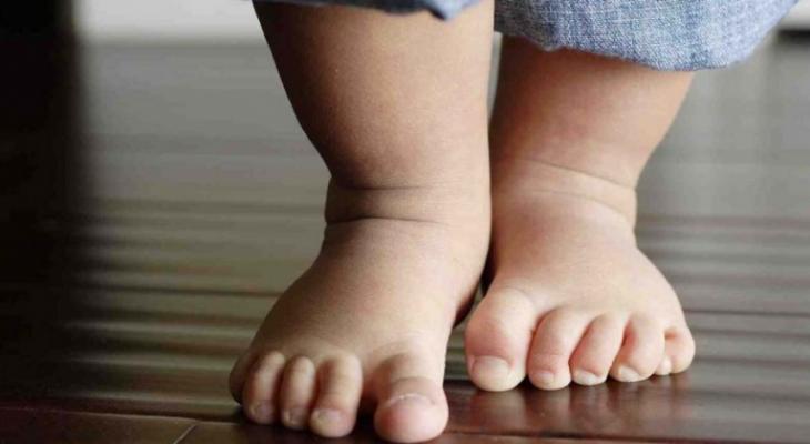 flat-feet-in-children-may-need-attention1-980x490