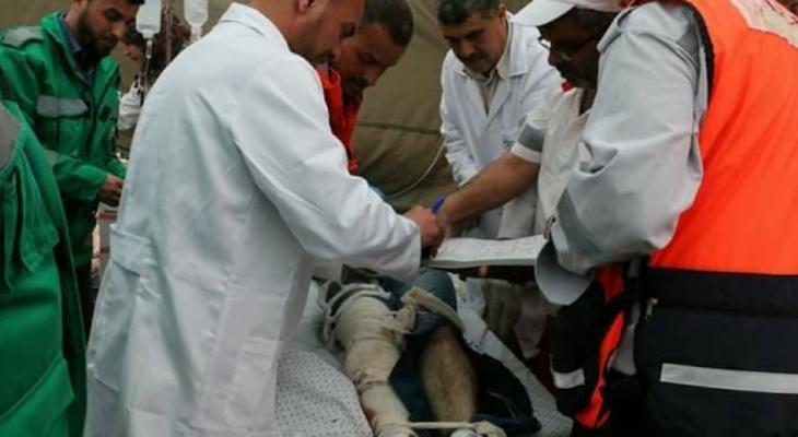 صحة غزة: نفاذ خيوط "برولين" الخاصة بعمليات جراحة الأوعية الدموية