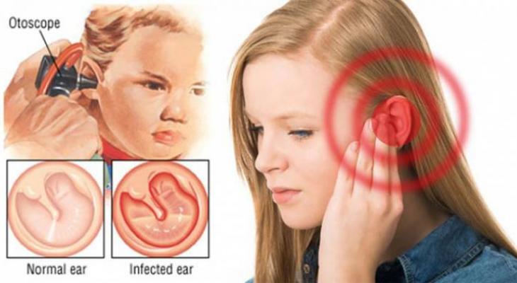 earinfection-728x387-jpg-7660520608401205