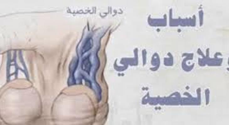 علاجات طبيعية للتخلص من الدوالي في الخصيتين