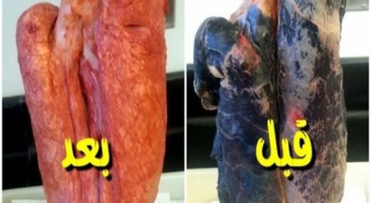 بالفيديو.. افضل طريقة للتخلص من النيكوتين بالجسم خلال 72 ساعة