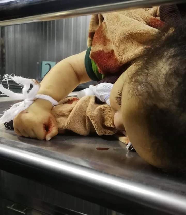 محدث بالصور: 3 شهداء بينهم طفلة ووالدتها بقصف إسرائيلي مستمر على قطاع غزّة