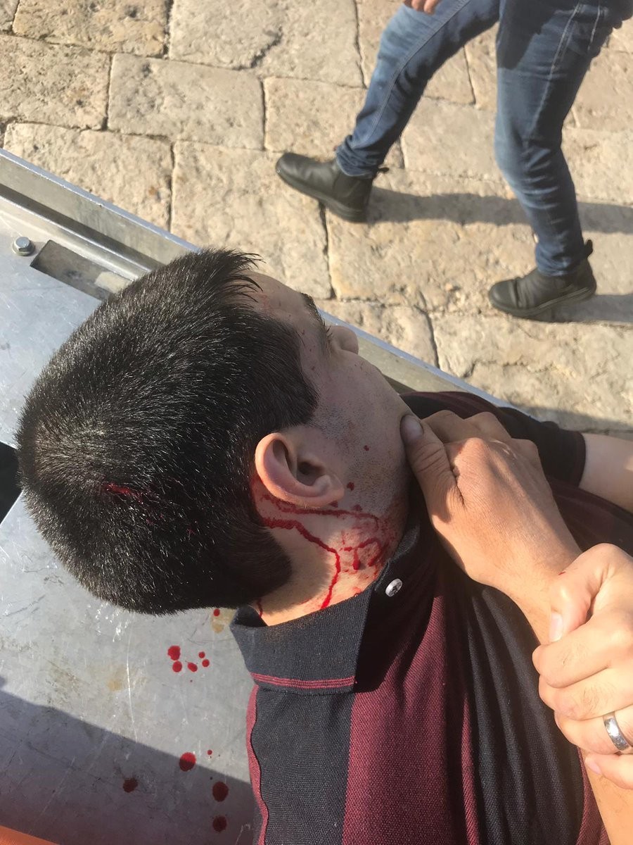 إصابات واعتقالات في صفوف المعتكفين بالمسجد الأقصى جراء عنجهية الاحتلال