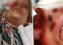 شاهدوا: مغربي يصب "الزيت المغلي" على وجه "زوجته" أثناء نومها