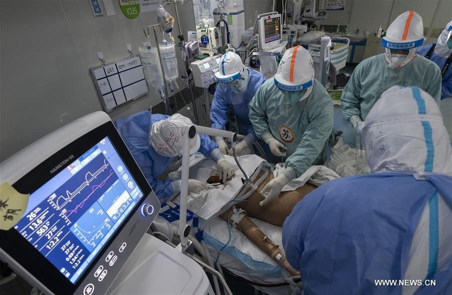 بالصور: نزع جهاز التنفس عن مريض بكورونا في الصين واستعادة الرئتين وظائفهما