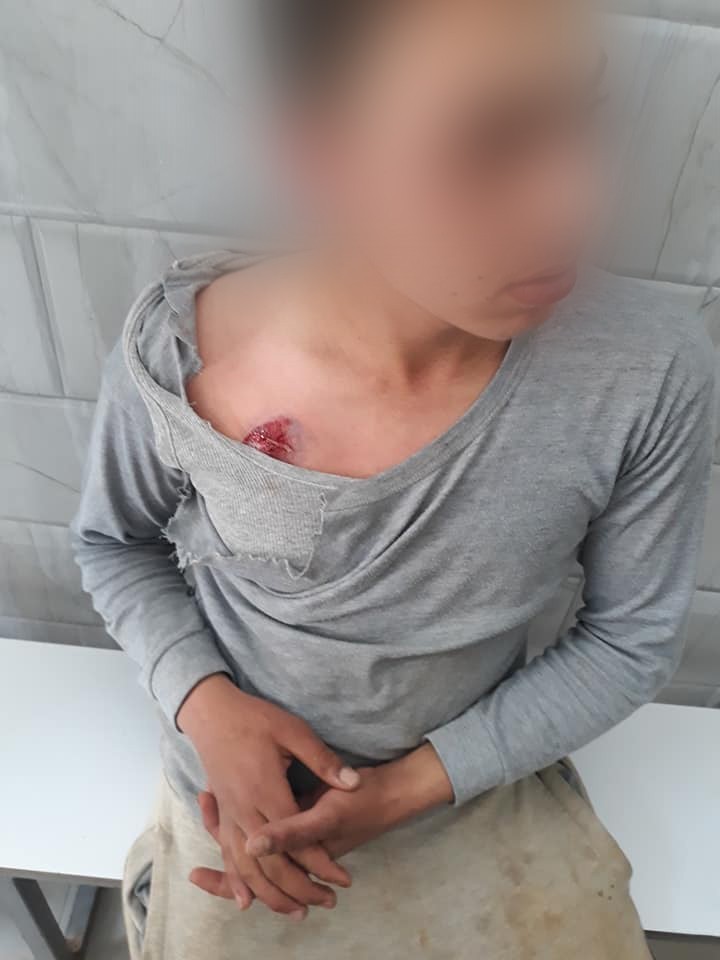إصابات خلال مواجهات مع الاحتلال في جنين