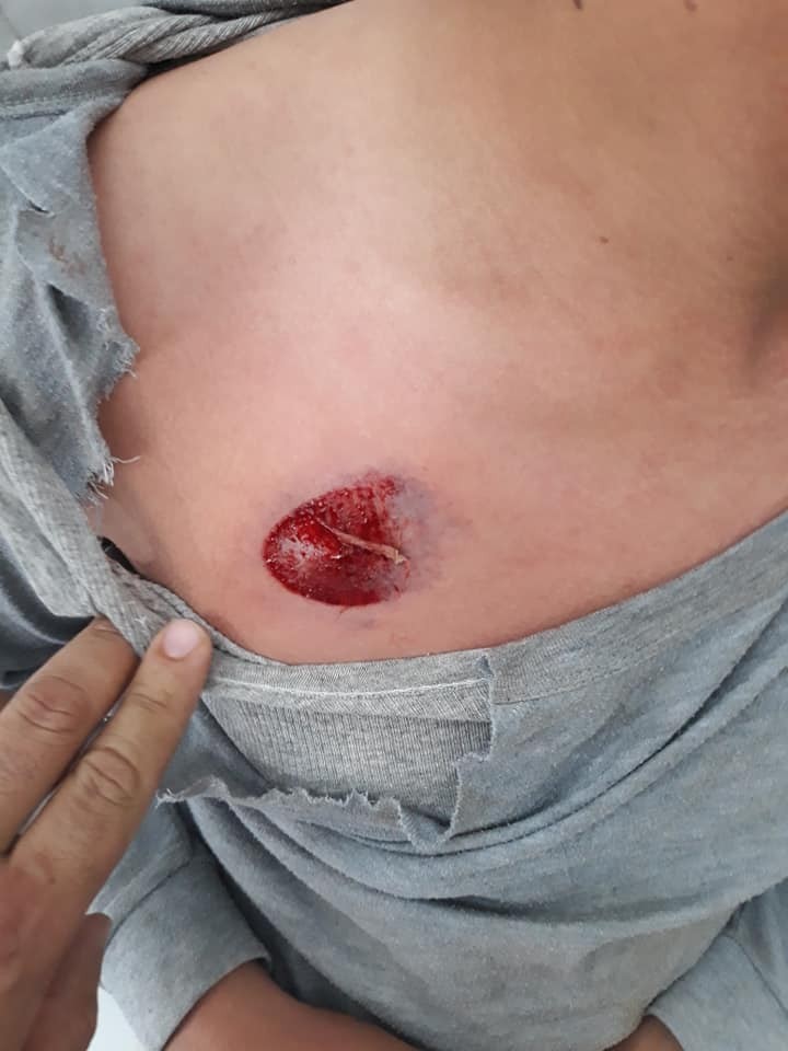 إصابات خلال مواجهات مع الاحتلال في جنين