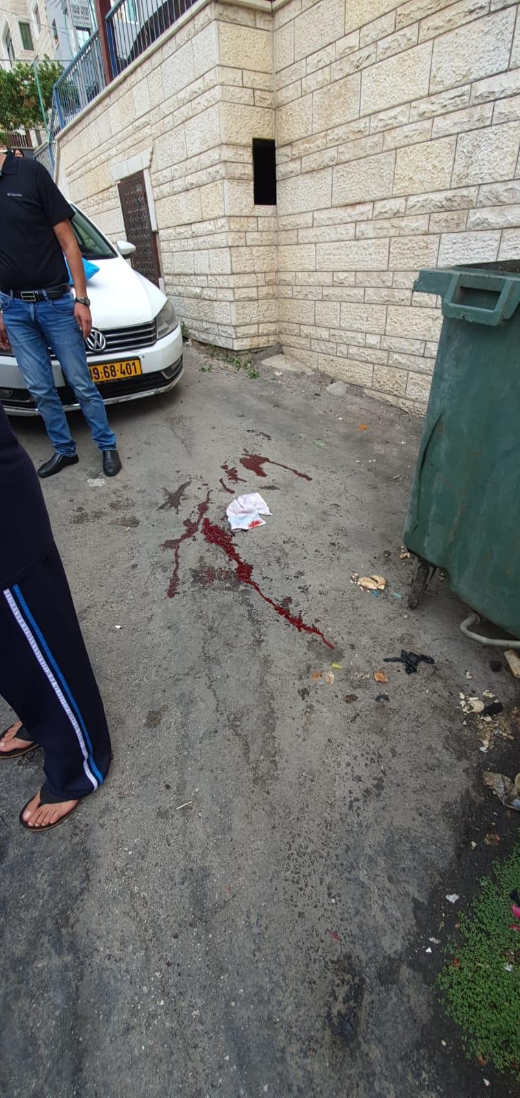 إصابة مواطن إثر تعرضه لإطلاق نار في سخنين