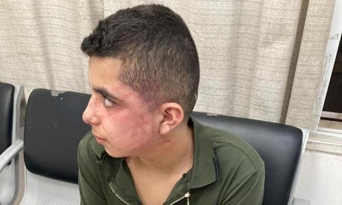 شاهد: الاحتلال يعتدي على فتى بالضرب المبرح في الطيبة