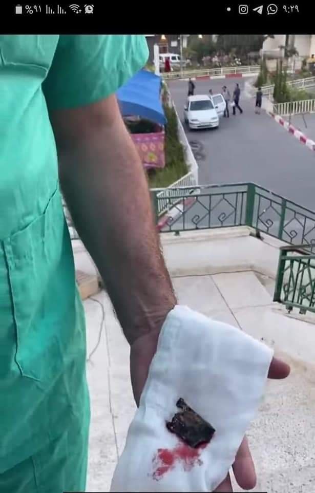 شاهد: هذا ما استخرجته الطواقم الطبية من أجساد المصابين بغزة جراء العدوان