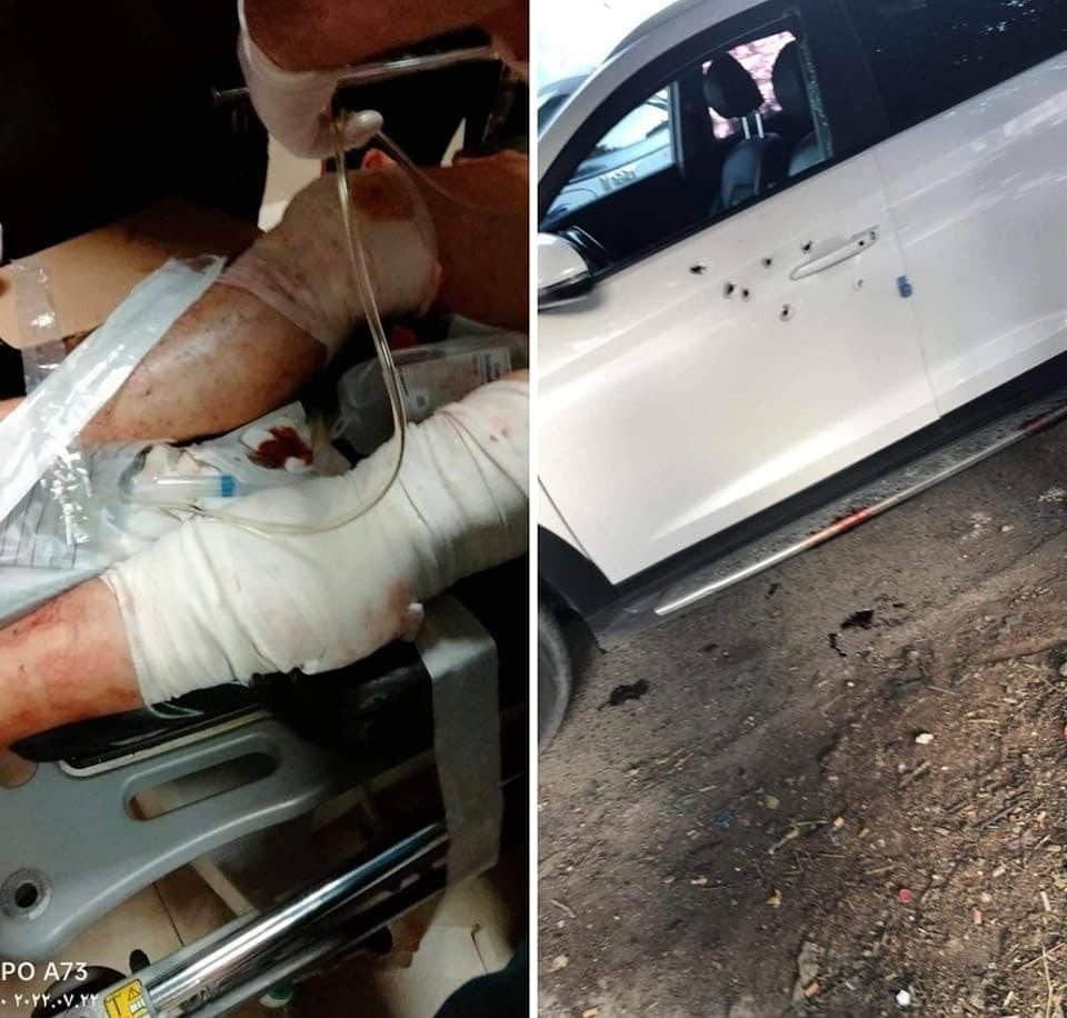 بالصور: إصابة ناصر الدين الشاعر برصاص مجهولين في نابلس