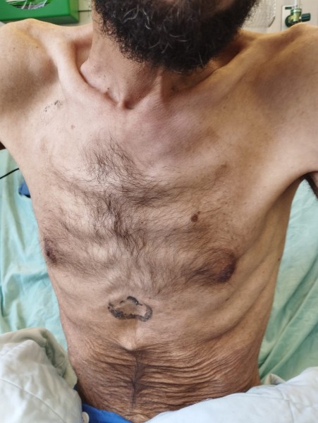 شاهد الصور: الأسير خليل عواودة هيكل عظمي نتيجة إضرابه عن الطعام