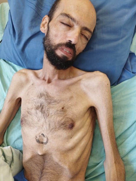 شاهد الصور: الأسير خليل عواودة هيكل عظمي نتيجة إضرابه عن الطعام