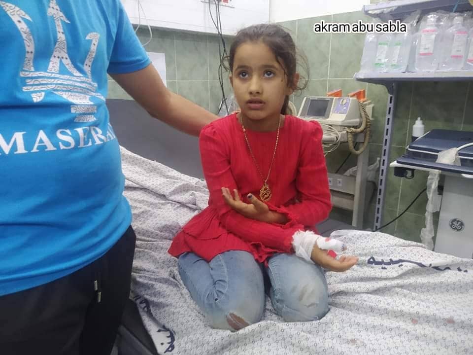 إصابة 4 أطفال إثر استهداف مجموعة مواطنين شرق رفح 