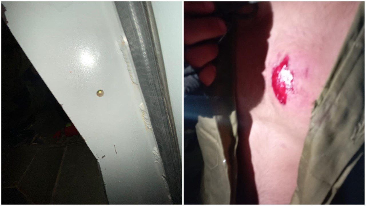 إصابة جندي عن طريق الخطأ بمدينة نابلس