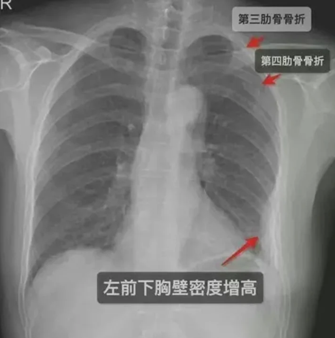 335330-أشعة-المرأة-الصينية.png