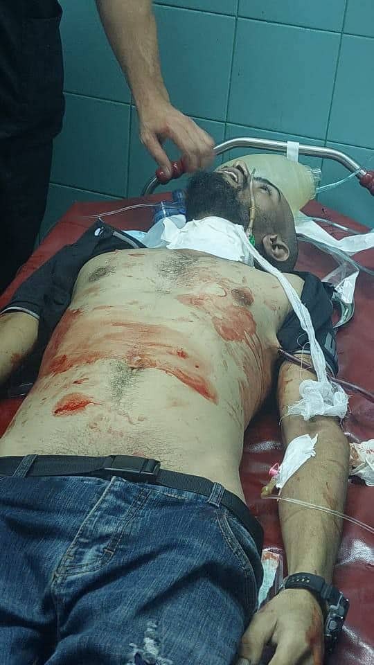شهيد وعشرات الإصابات خلال اقتحام جيش الاحتلال جنين فجر اليوم