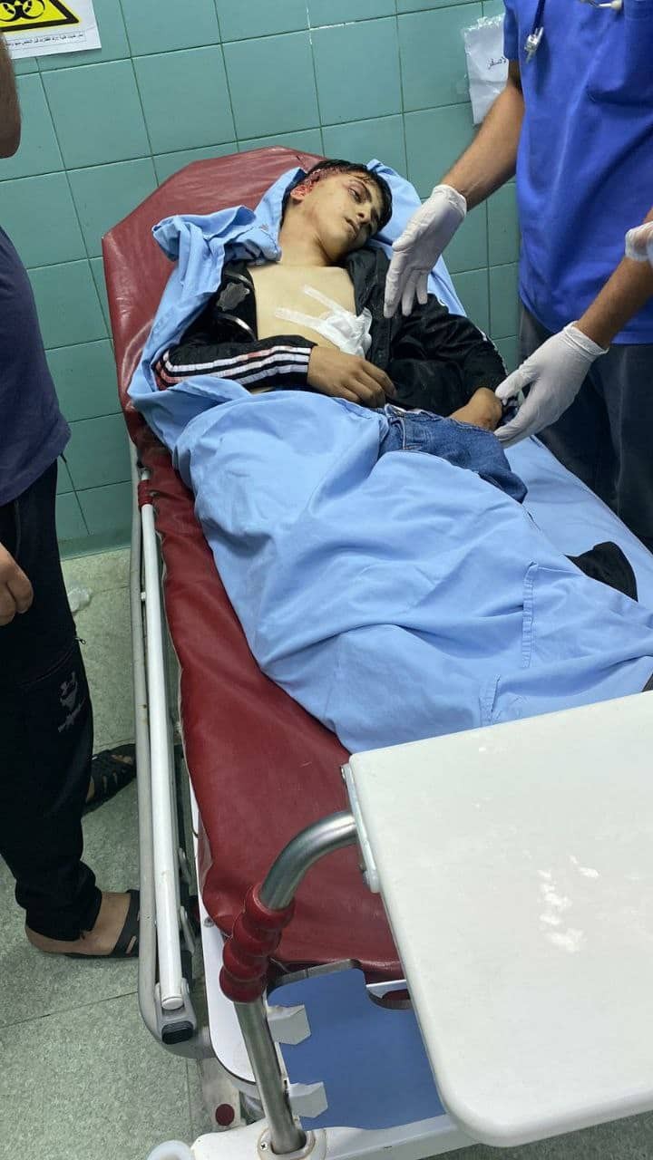 استشهاد فتى و3 إصابات إحداها خطيرة برصاص الاحتلال خلال اقتحام كفر دان غرب جنين