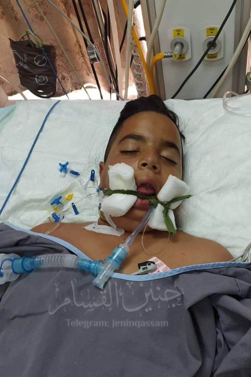 استشهاد طفل متأثرًا بجراحه برصاص الاحتلال في جنين