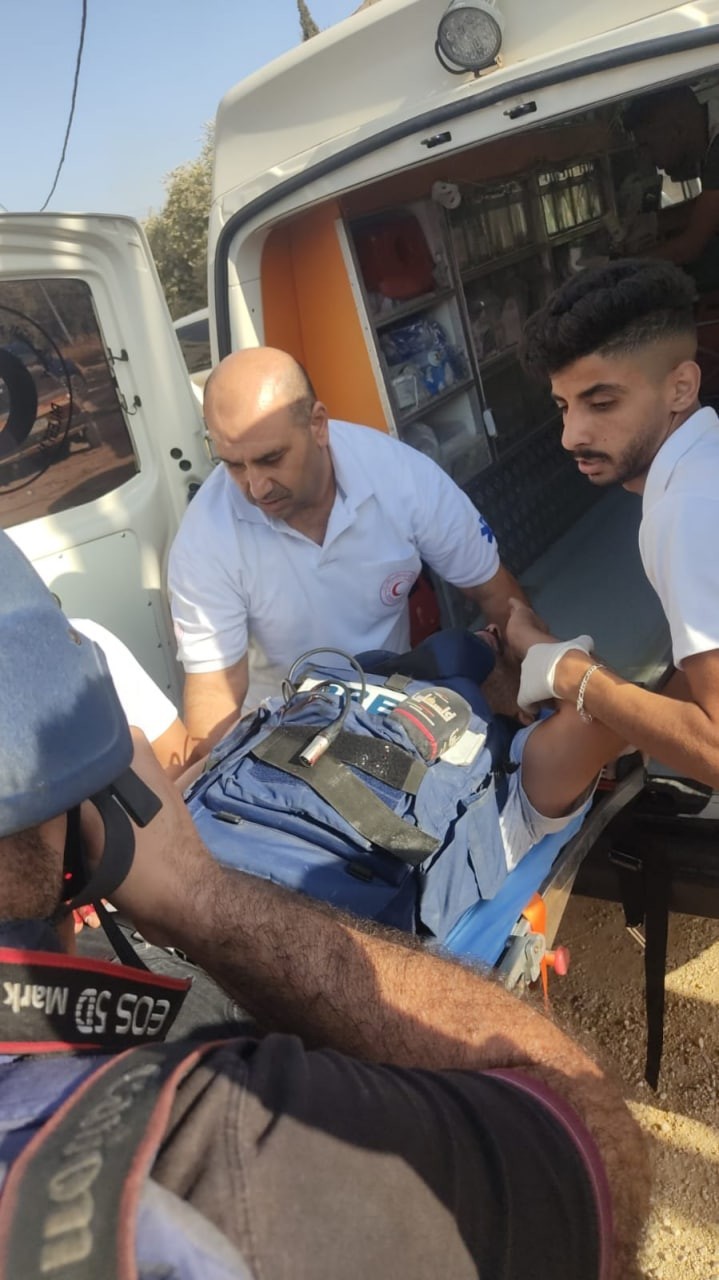 بالصور: إصابة صحفيين من طاقم تلفزيون فلسطين خلال تغطيتهم أحداث نابلس
