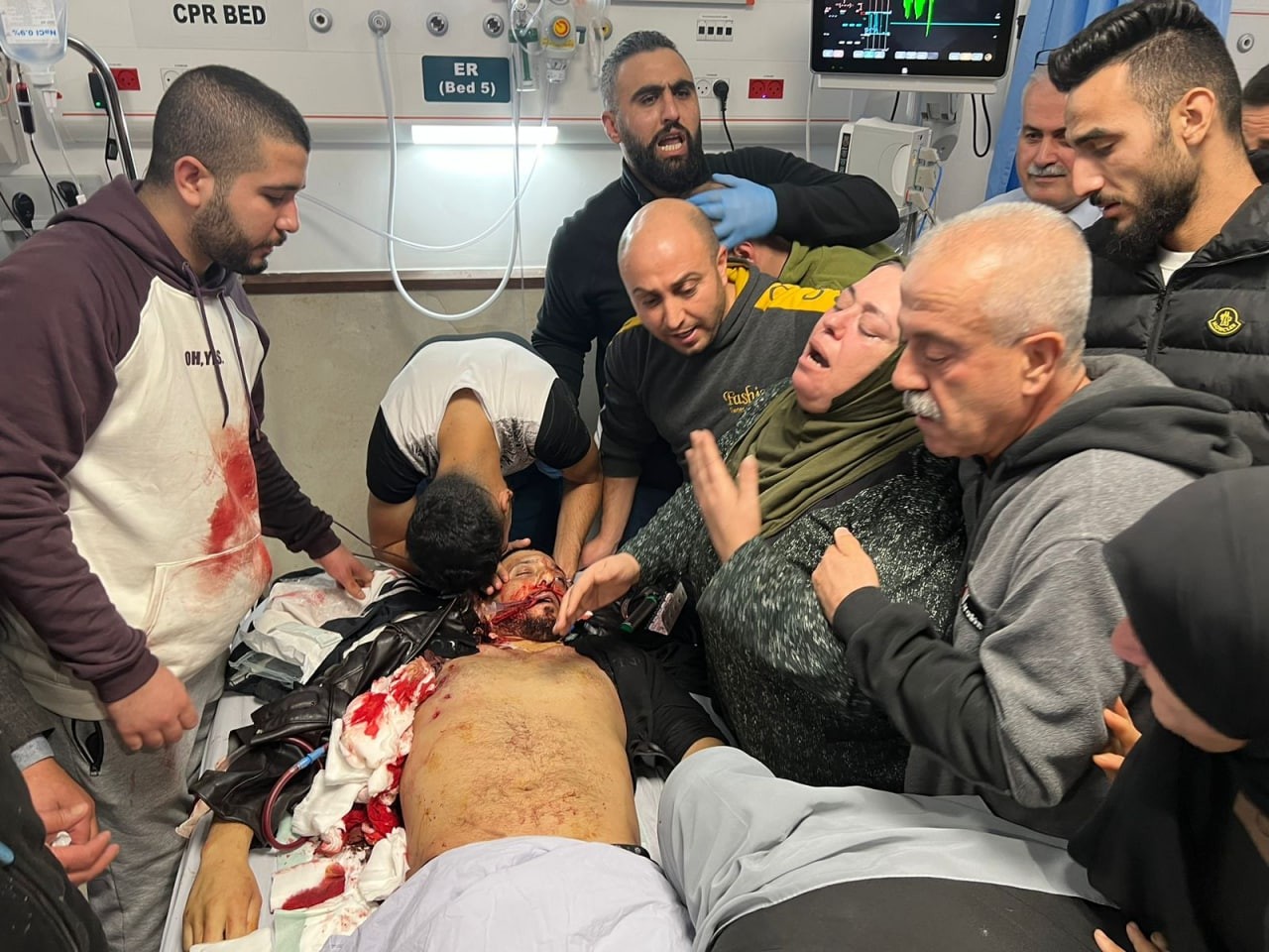 شاهد: استشهاد شاب متأثرًا بجراحٍ أصيب بها برصاص الاحتلال في بلدة يعبد بجنين
