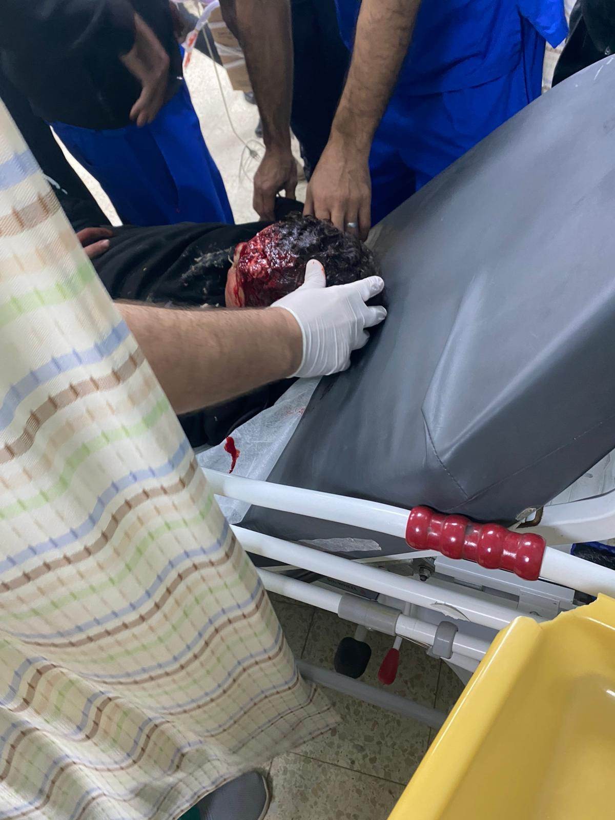 إصابة حرجة لفتى خلال مواجهات مع الاحتلال في مخيم عقبة جبر بأريحا