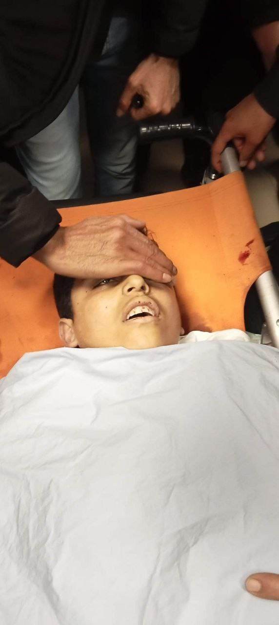 الصحة: استشهاد طفل من جنين متأثرًا بإصابته برصاص الاحتلال