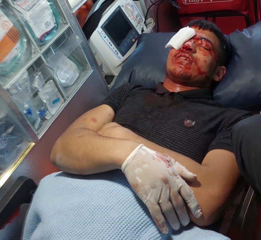 إصابات خلال مواجهات مع الاحتلال في قراوة بني حسان